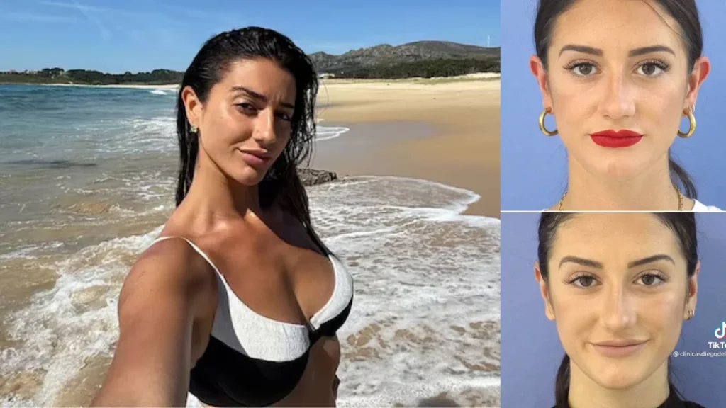 Fati Vázquez antes y después: Las cirugías estéticas de la novia de Lamine Yamal