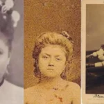 Blanche Dumas: Quién era, edad y lo que se sabe de la mujer de tres piernas