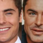 ¿Qué le paso a Zac Efron en la cara 2025? Actualidad, fotos y cirugías del actor