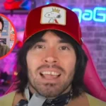¿Qué le pasó a German Garmendia en los dientes?, ¿qué cirugía se realizó?