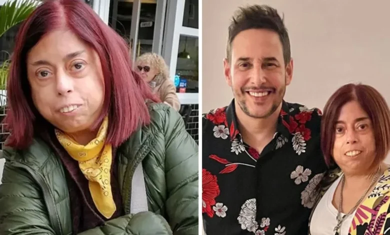 Meche Portillo antes: fotos de cómo lucía y cuál era la enfermedad que tenía