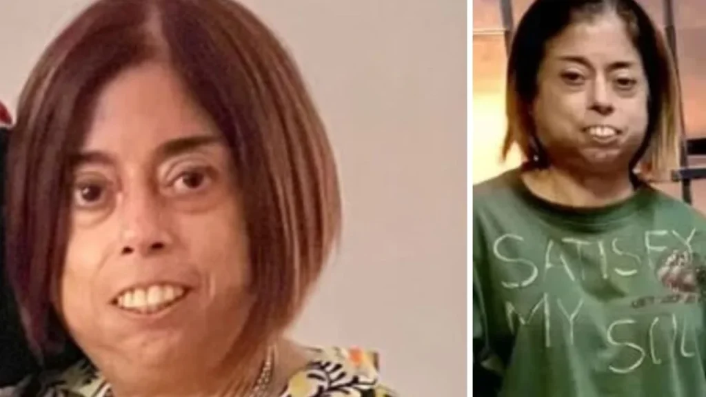 ¿Meche Portillo qué tenía en la cara? ¿De qué murió la productora de 'Intrusos'?