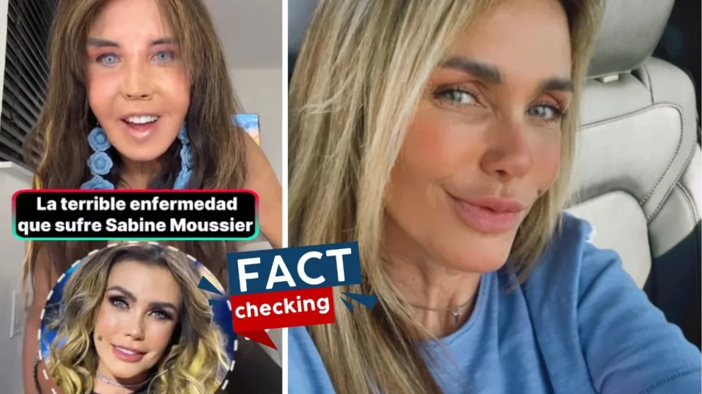¿Qué le pasó a Sabine Moussier en la cara? ¿Qué tiene en la nariz? ¿Enfermedad?