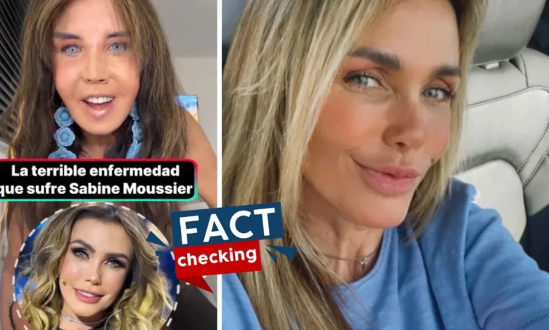¿Qué le pasó a Sabine Moussier en la cara? ¿Qué tiene en la nariz? ¿Enfermedad?