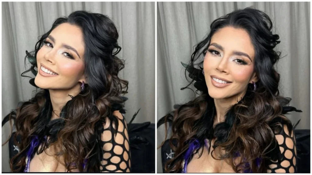 ¿Quién es Dorismar? Su carrera y el impacto de cirugías estéticas fallidas