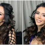 ¿Quién es Dorismar? Su carrera y el impacto de cirugías estéticas fallidas