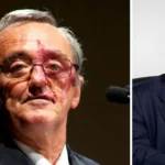 Mariano Barbacid mancha en la cara: ¿Tiene alguna enfermedad?