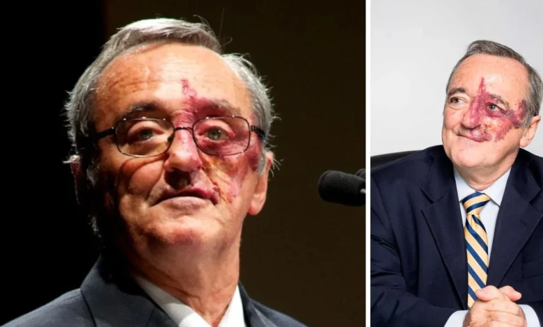 Mariano Barbacid mancha en la cara: ¿Tiene alguna enfermedad?