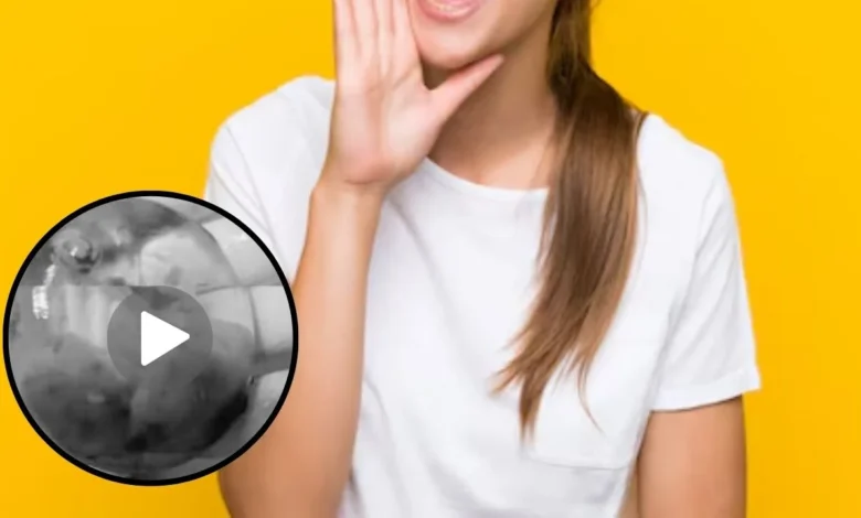 “Aborto amarillo” video filtrado: ¿Clip sin censura en Twitter y Forogore? ¿De qué trata?