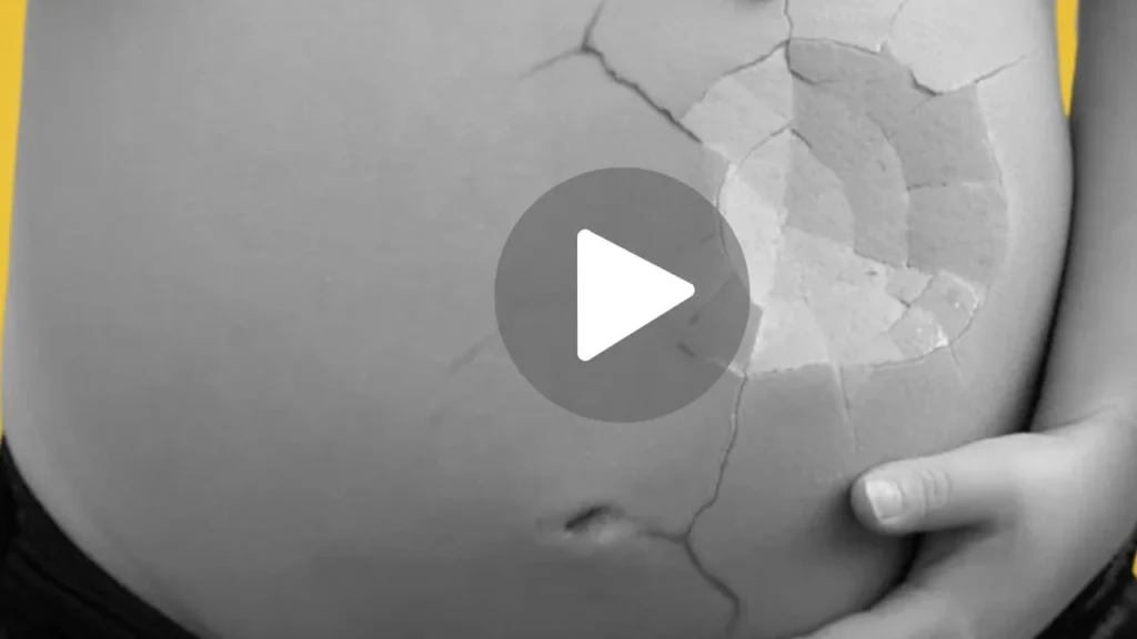 Aborto amarillo video viral: ¿Se puede ver el clip en Twitter o forogore?