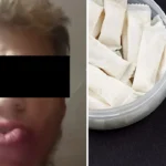 Chico que usaba snus fotos: ¿la historia del joven que se le cayó la boca es real?
