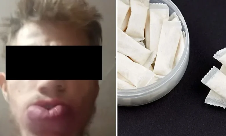 Chico que usaba snus fotos: ¿la historia del joven que se le cayó la boca es real?