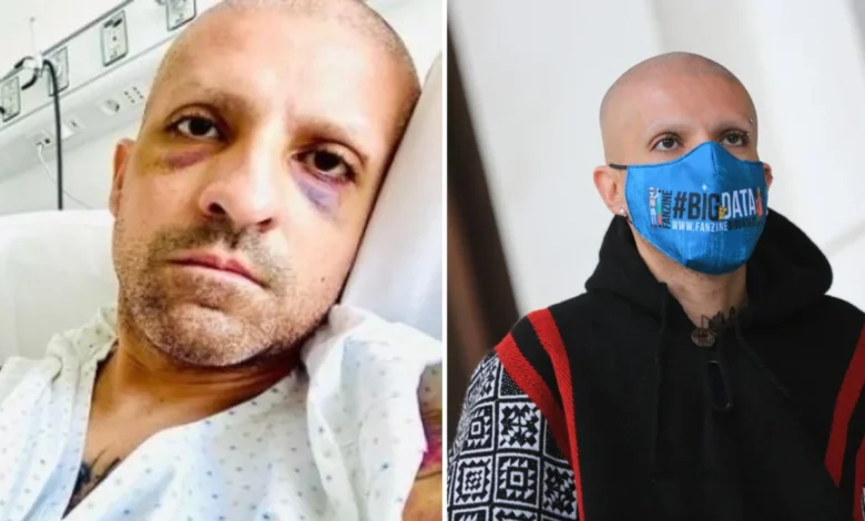 ¿Qué enfermedad tiene Rodrigo Rojas Vade? ¿Padece VIH/SIDA o cáncer? ¿Qué le pasó hoy?