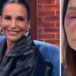 ¿Qué le pasó a Ivete Sangalo? Accidente y estado actual de la cantante