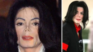 ¿Michael Jackson tenía cáncer? ¿Qué enfermedad tenía, qué es vitiligo?